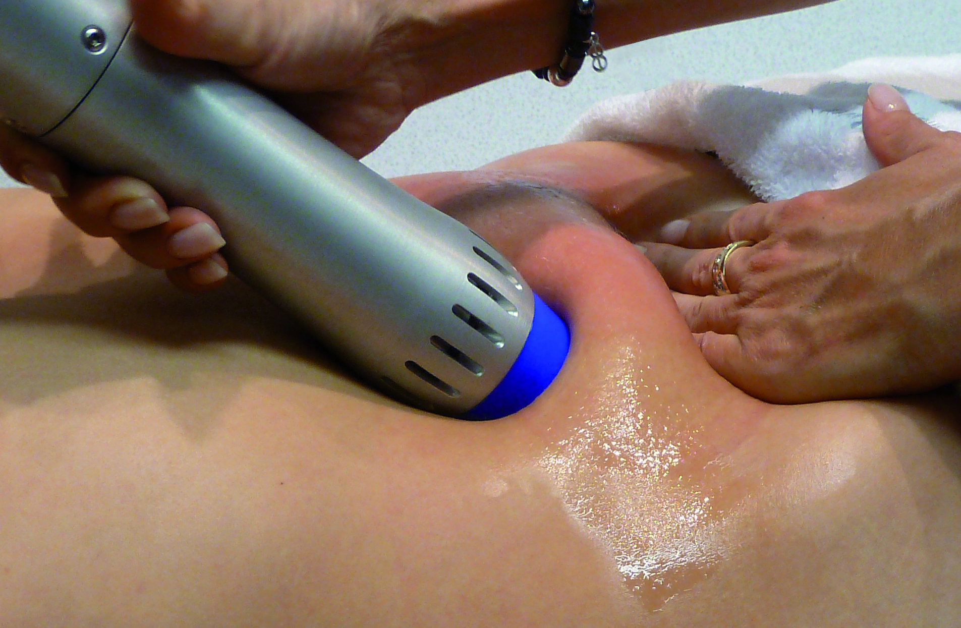 Zimmer ZWave Acoustical Wave Therapy to Stimulate Collagen Formation